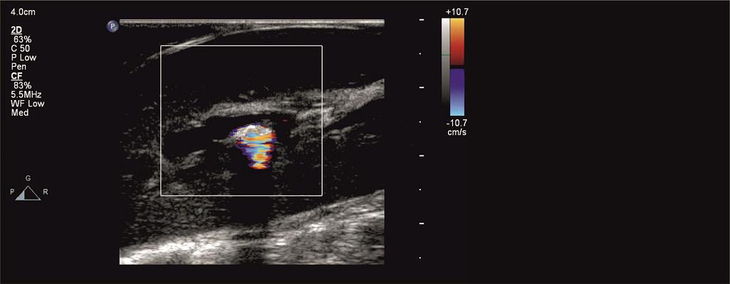 Ultrasound imaging methods in medicine